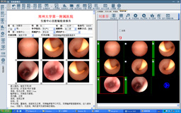 VisionPACS内镜系统